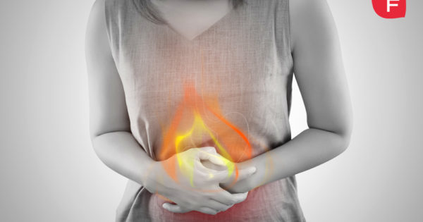 Acidez estomacal: ¿cómo evitar y prevenir el reflujo gastroesofágico?